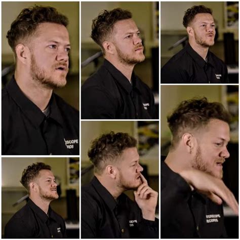 Has Dan Reynolds gone through hair transplant : .